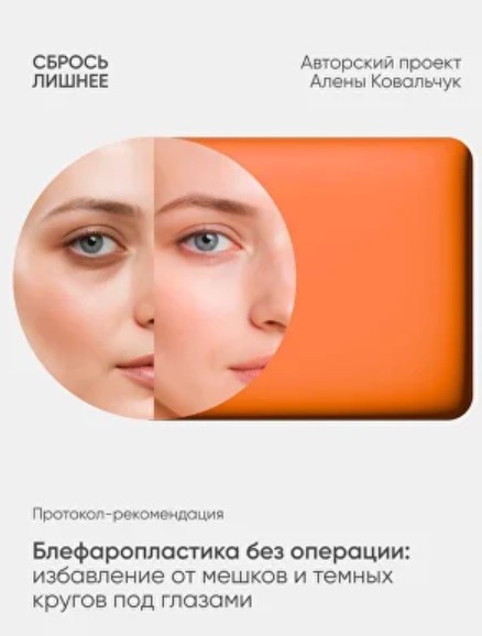 Алена Ковальчук - Протокол-рекомендация Блефаропластика без операции