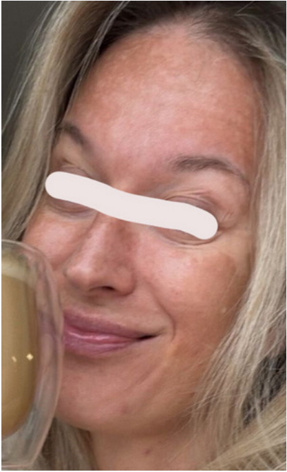 Ярослава Науменко - Против пигментации: рационы, уход, добавки, косметика