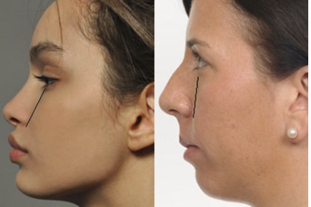 Ярослава Науменко - Новое лицо. Восстановление прикуса и симметрии