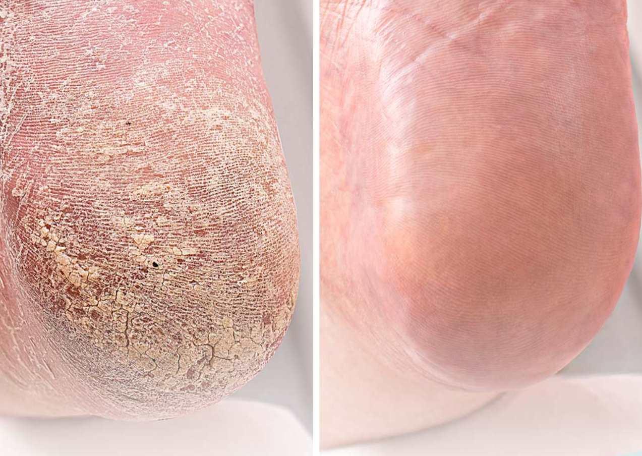 Ангелина Нышонкова - Вебинар Трещины – это просто. Тариф Pro