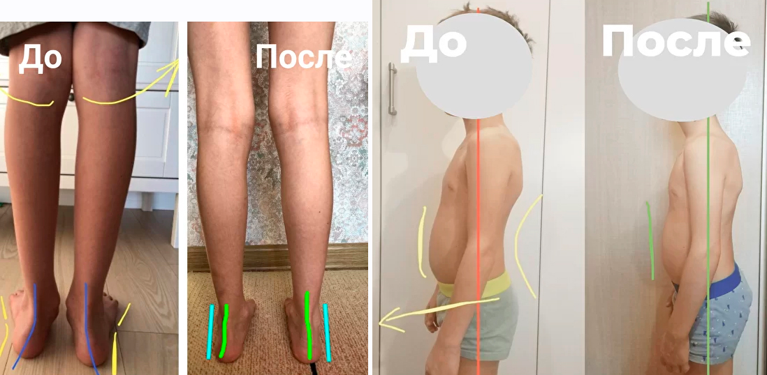 Здоровые стопы и осанка за лето. Курс оздоровительных упражнений для детей 4 / Юлия Маркелова - 12 лет