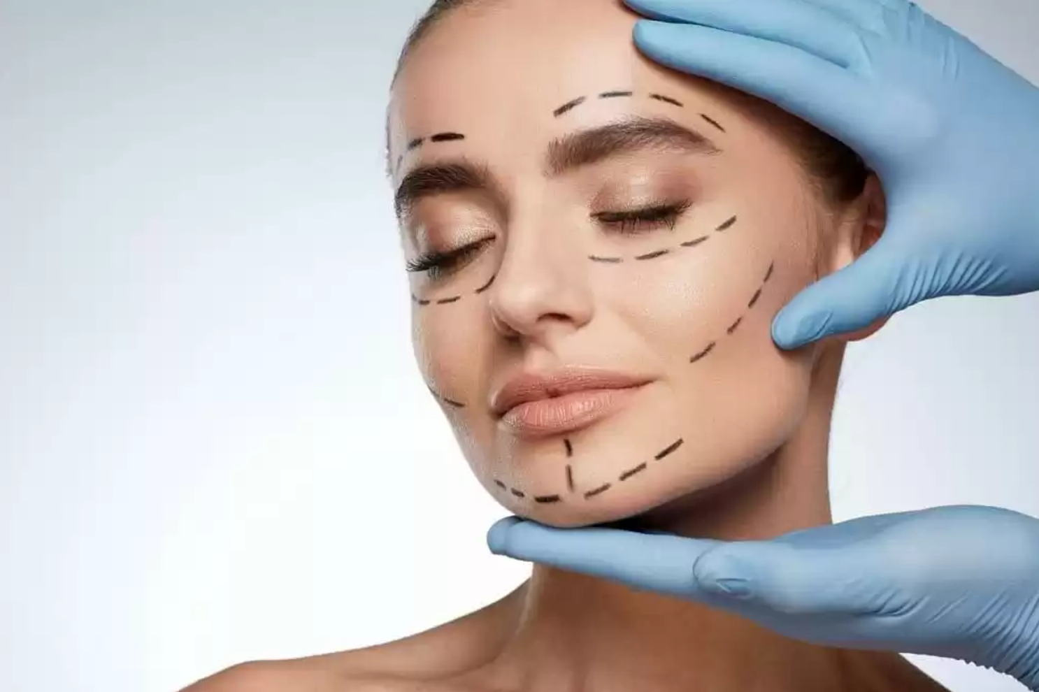 Akkord / Елена Разумовская - Ботулинотерапия Full-Face