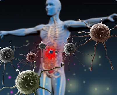 humberto 2.0 / Валерий Подрубаев - Аутоиммунные процессы - война против тебя. Первый тариф