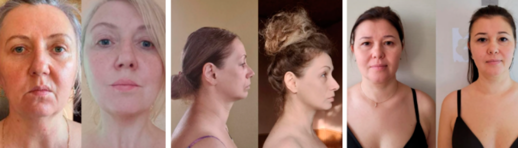 Елена Гондорчин - Лекторий. Платформа для практик. Модуль 2. Восстановление лица